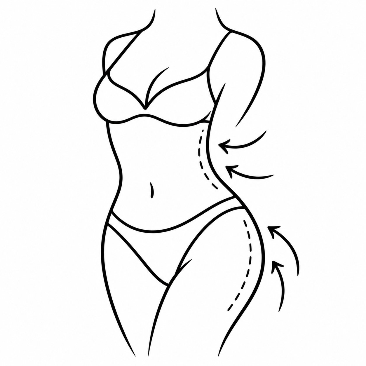 Body Fillers